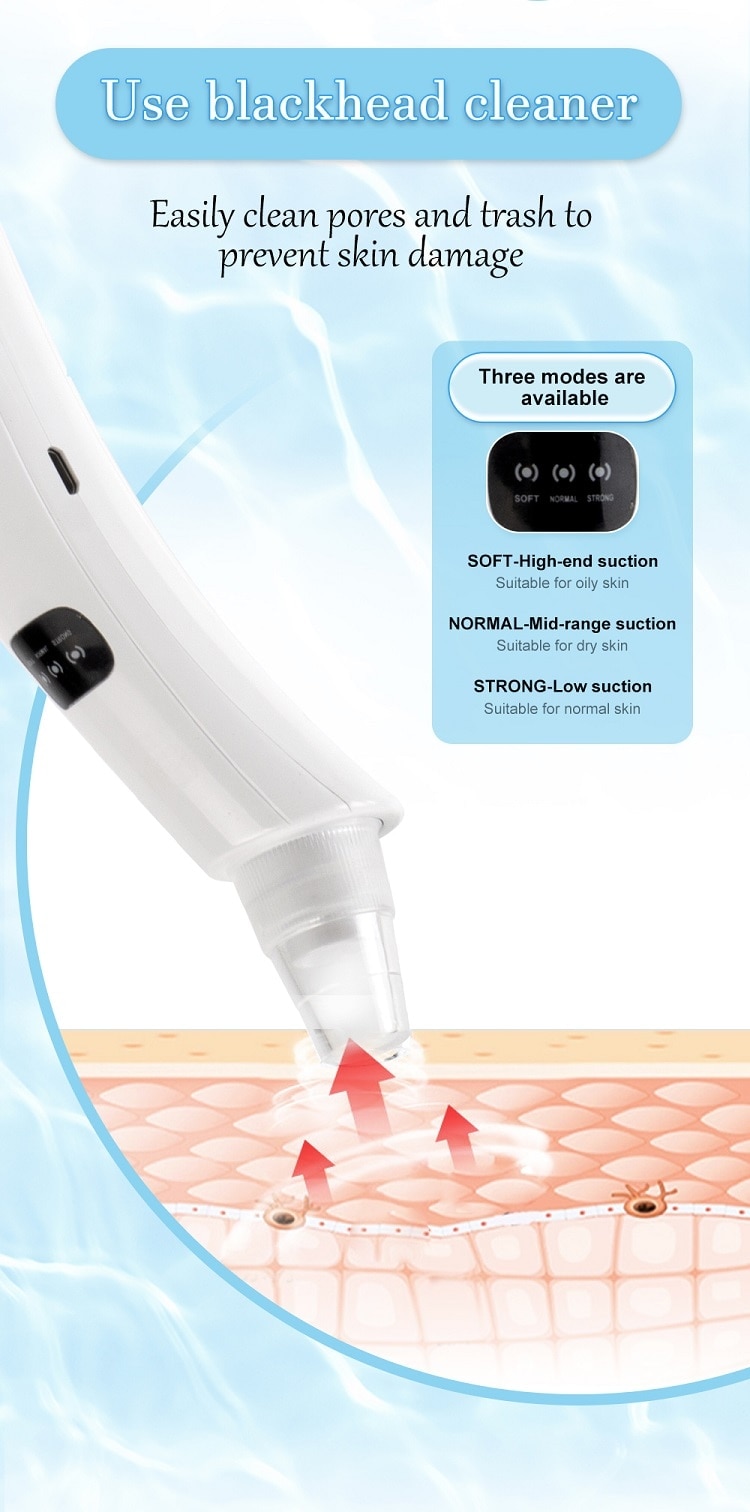 Vacuum Blackhead Removal