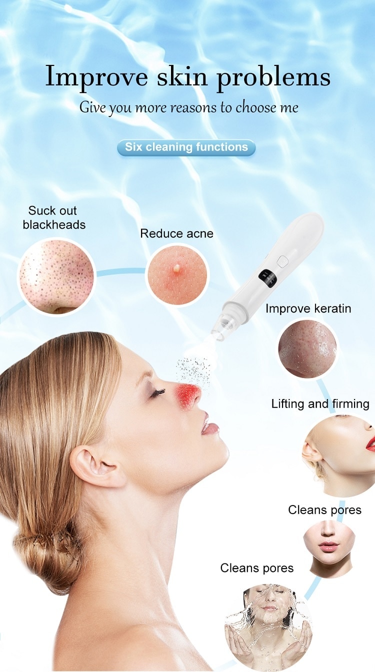 Vacuum Blackhead Removal